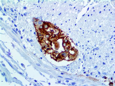 Varicella Zoster Virus - MMab - Bio SB