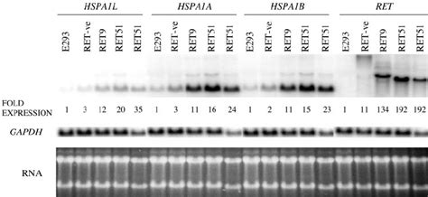 Expression of HSP70 gene family in response to RET. Northern analysis... | Download Scientific ...