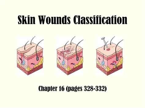 PPT - Skin Wounds Classification PowerPoint Presentation, free download - ID:853573