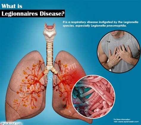 Legionella Bacteria Treatment