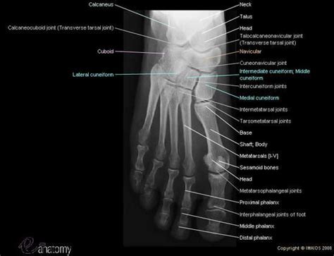 Superior radiograph of the foot with all anatomical structures labeled (bones, joints ...