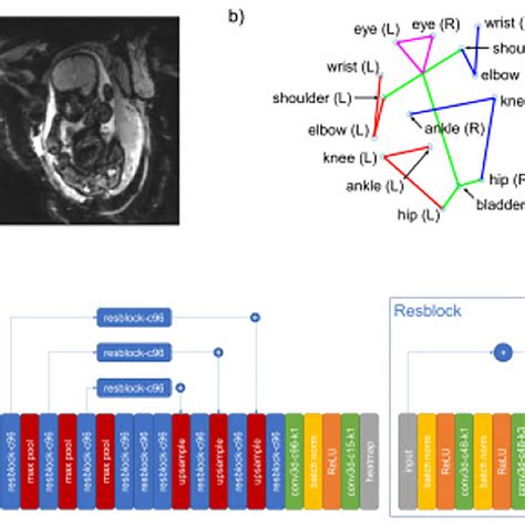 a) An example of the fetal MRI data in our dataset. b) The... | Download Scientific Diagram