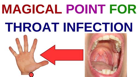 Causes Of Throat Infections