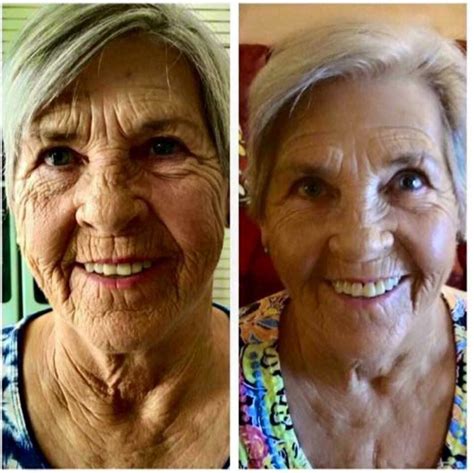 Never to old too start!! Look at these results!!🔥🔥 | Face exercises, Face yoga, Face lift exercises