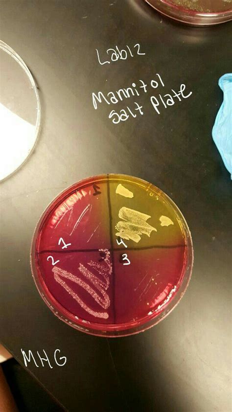 Pin by Maggie Galloway on Microbiology | Microbiology, Plates