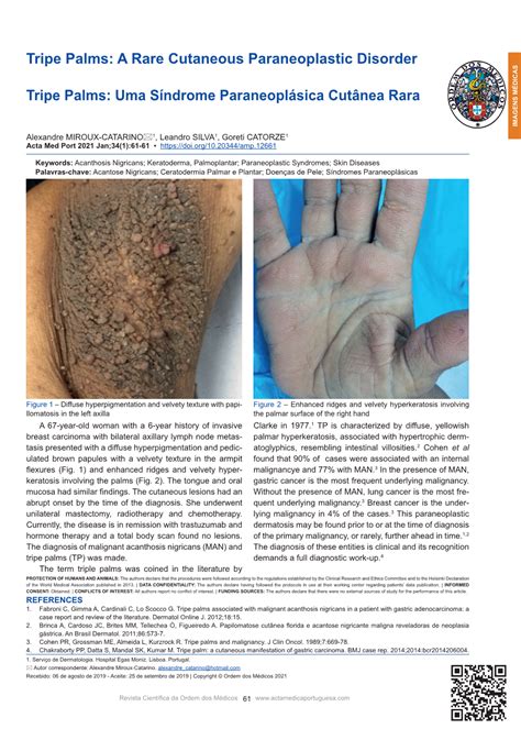 A Rare Cutaneous Paraneoplastic Disorder Tripe Palms - DocsLib