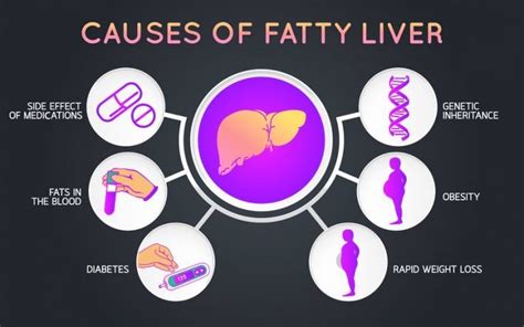 Fatty liver: symptoms, prevention, causes and treatment - GreenBHL