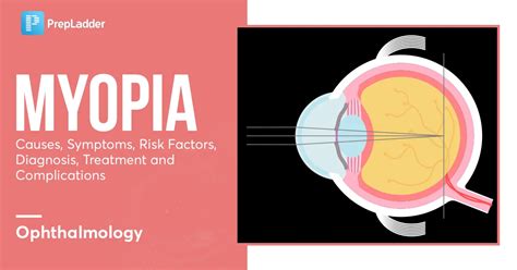 Myopia: Causes, Symptoms, Risk Factors, Diagnosis, Treatment and ...