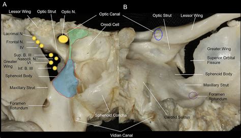 Sphenoid Bone Optic Foramen