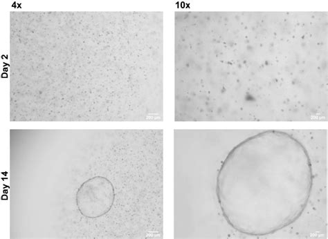 Generation of organoids from liver biopsy. | Download Scientific Diagram