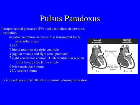 PPT - Pathophysiology of Pericardial Disease IMS 350 PowerPoint ...