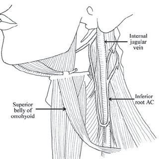 Superior root of the ansa cervicalis (AC) located below the posterior... | Download Scientific ...