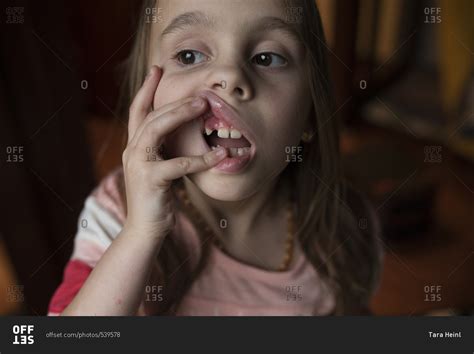 Portrait of young girl showing her missing tooth stock photo - OFFSET