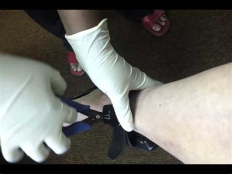 Scram Bracelet Removal - YouTube