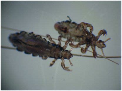 Scabies, lice, and myiasis | Oncohema Key