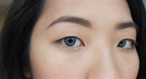 Double eyelid surgery in Singapore: the complete guide to getting big ...