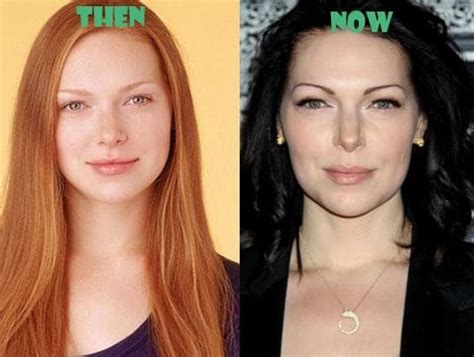 Laura Prepon Plastic Surgery Before And After