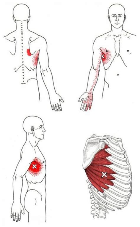 Serratus Anterior - Muscle of the Month at Yoganatomy.com | Trigger ...