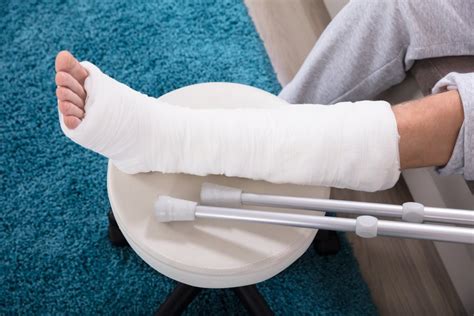 What Is the Average Settlement for a Broken Leg? | 24/7 Help