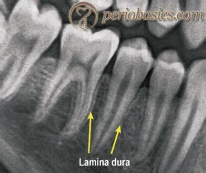 Alveolar bone – periobasics.com