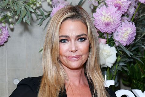 Denise Richards claims she's never used Botox of fillers