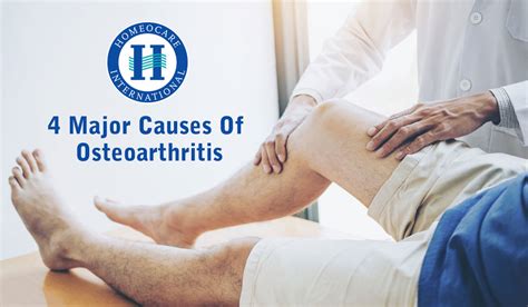 4 Major causes of osteoarthritis ‣ Arthritis | Homeocare International