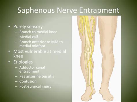 Calf Nerve Entrapment