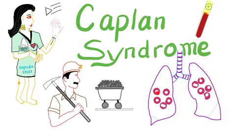 Caplan Syndrome | All You Need To Know 👨🏻‍🚒 - YouTube