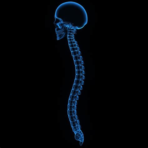 Myelomalacia – Spinal Cord Softening | Sinicropi Spine