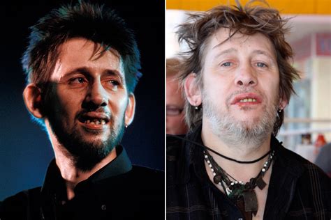 Someone is making a Christmas documentary about Pogues frontman Shane MacGowan's teeth