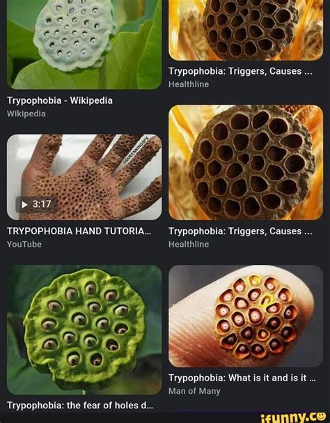 What Is Trypophobia Its Definition Causes Pictures And Cure Explained | Images and Photos finder