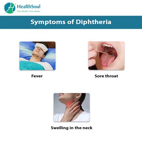 Diphtheria: Symptoms and Treatment | Internal Medicine | HealthSoul