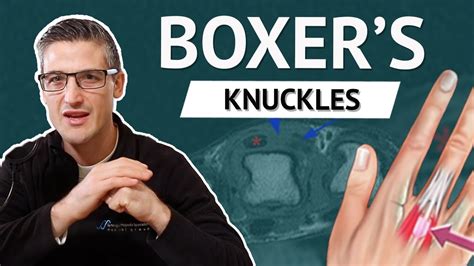 Boxer’s Knuckle (also known as Sagittal Band Injuries) and why your finger may not straighten ...