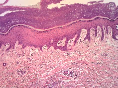 Keratinized Stratified Squamous Epithelium / Non Keratinized Stratified Squamous Epithelium ...