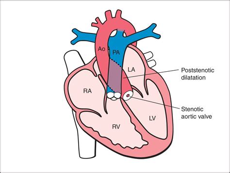 Atrioventricular Valve Diagram