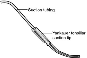 Yankauer sunction tip | definition of Yankauer sunction tip by Medical dictionary