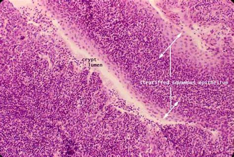 tonsil histology | Medical school studying, Recognition, My future job