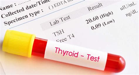 Why you need a Thyroid Blood Test? -Biocity Healthcare