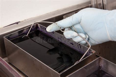 Scientist Staining Microscope Slides for Cytology Studies in the Laboratory Stock Photo - Image ...