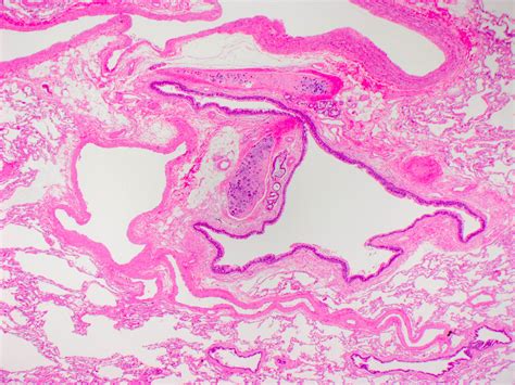 Terminal Bronchiole Histology