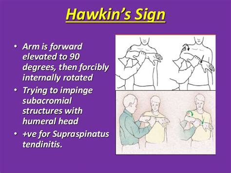 Examination of shoulder