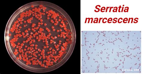 Serratia marcescens- An Overview