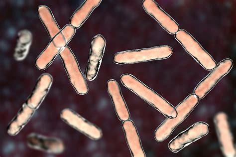 Nonviable, Heat-inactivated Bifidobacterium bifidum MIMBb75 Improves ...