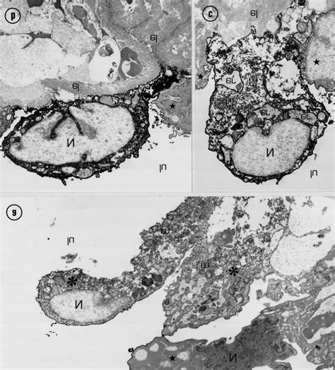 a–c. Electron micrographs of the umbilical artery (a) and vein (b, c)... | Download Scientific ...