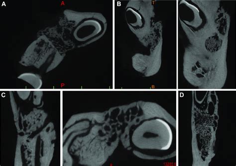 Micro-CT slices passing through the bone defects, filled with newly... | Download Scientific Diagram