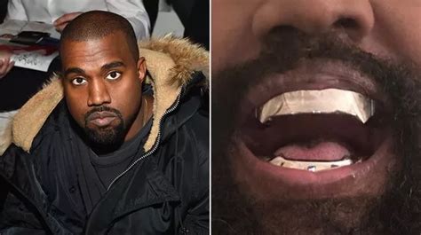 Kanye West debuts bizarre $850,000 titanium grills after having his ...