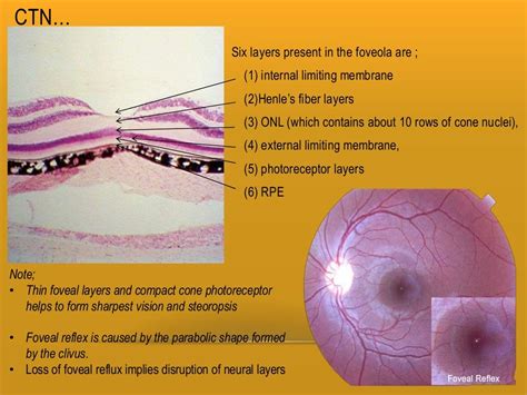 Retina and layers