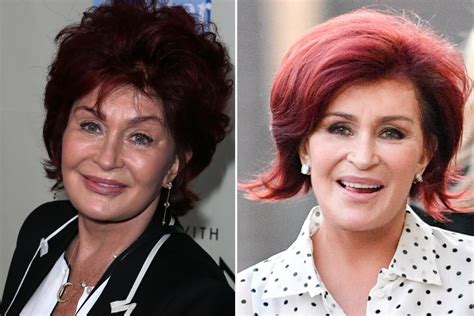 Sharon Osbourne's face before and after years of surgery