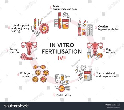 19 Steps Ivf Procedure Images, Stock Photos & Vectors | Shutterstock