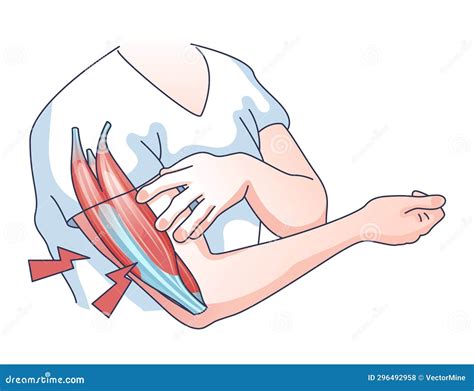 Muscle Weakness with Weak and Fatigue Muscular System Outline Concept ...